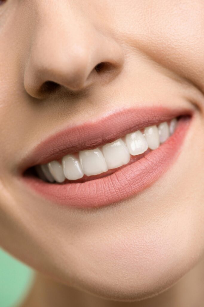 A close-up image focusing on a woman's smiling mouth, showing white teeth and pink lips.