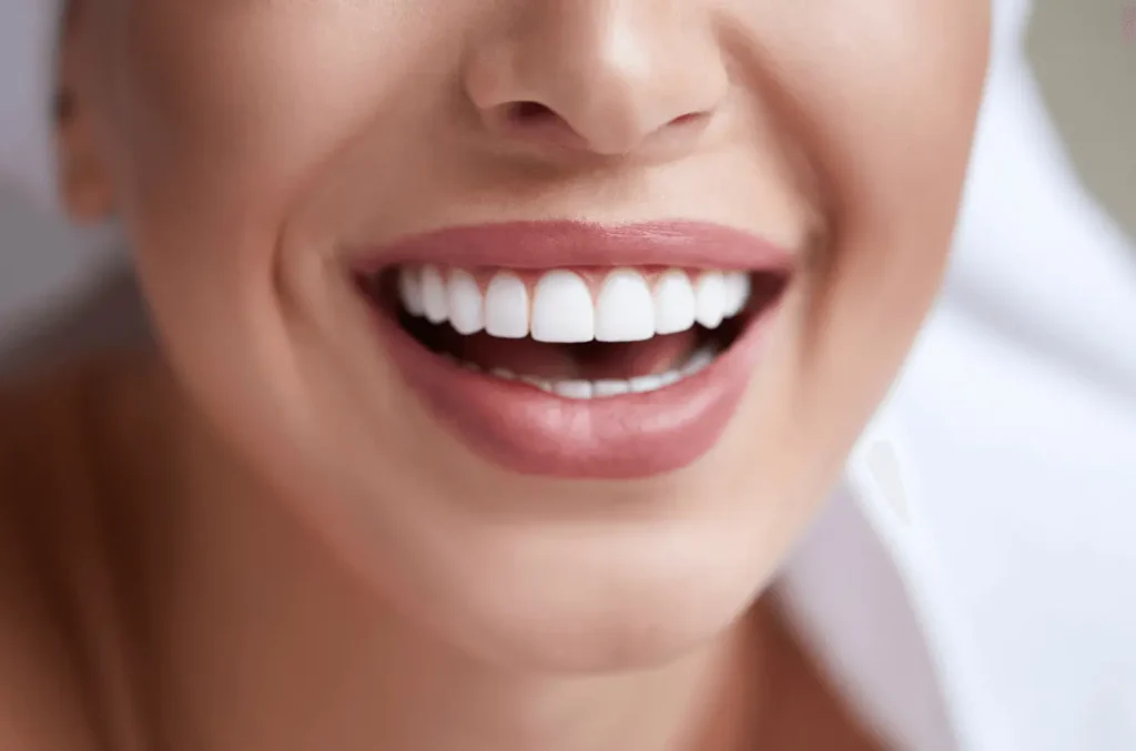 gulus-tasarimi-hollywood-smile