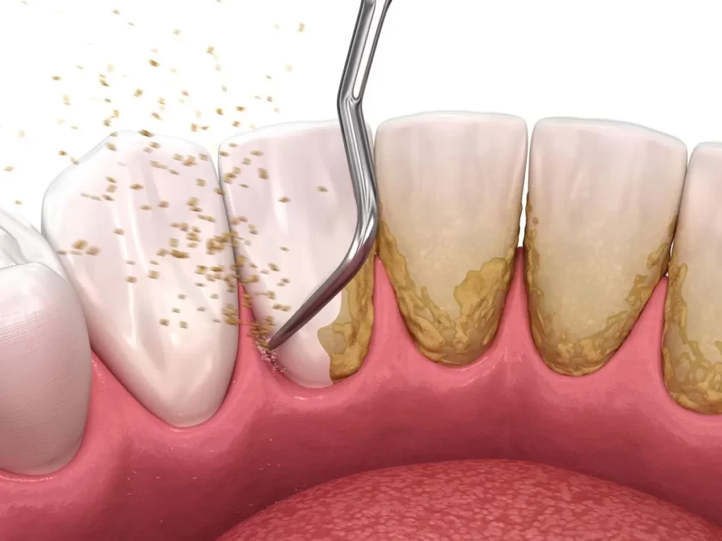 periodontoloji-1024x768_1775162482